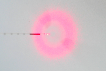 Laser varices
