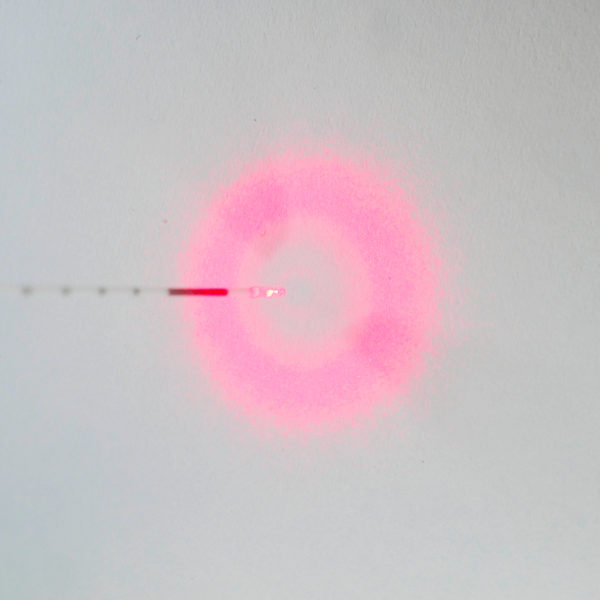 Laser varices